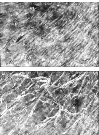 Figure 3. Couche cornée  d’aspect estival normal en  microscopie électronique à  balayage