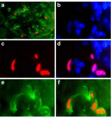 Fig. 4 Serum CXCL12 levels in Spiegelmer-treated db/db mice.