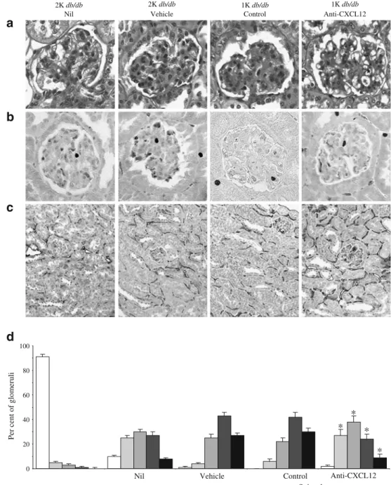 Fig. 5 Renal pathology in 6- 6-month-old sham-operated (2K) db/db mice or db/db mice with one kidney (1K)