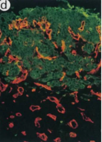 Figure 2. Immunofluorescence labeling of malignant  kerati-nocytes and vessels 2 wk after implantation