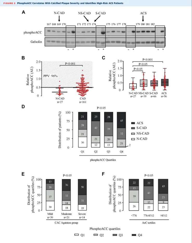 FIGURE 3 PhosphoACC Correlates With Calciﬁed Plaque Severity and Identiﬁes High-Risk ACS Patients