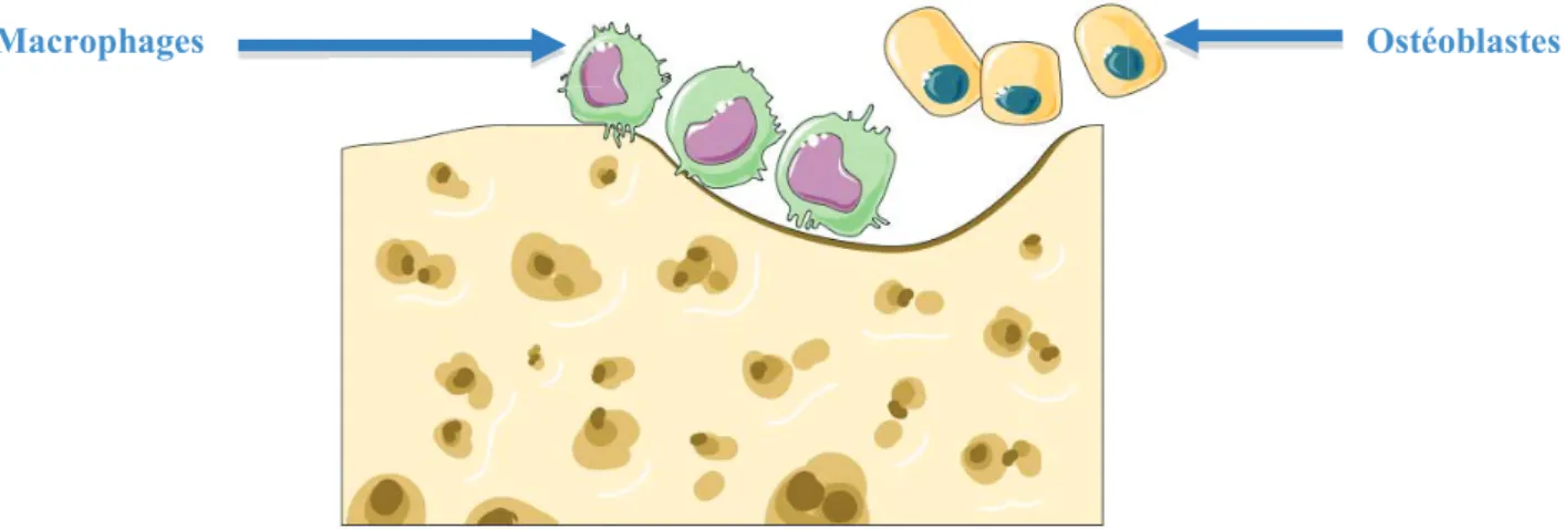 Figure 8 : Régularisation de la lacune par les macrophages [64].