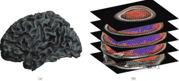 Figure 4: Template meshes used for distributed source imaging. (a) “Normal” cortical template mesh (8196 vertices), left view