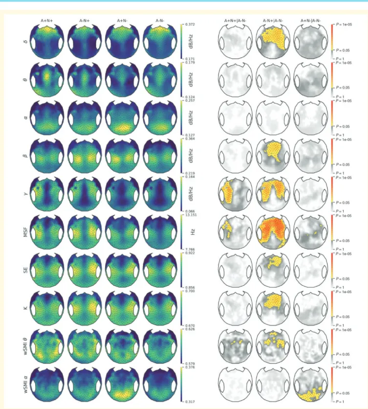 Figure 6 224 electrodes topographical maps of EEG metrics. The topographical 2D projection (top = front) of each measure [nor- [nor-malized power spectral density in delta (d), theta (y), alpha (a), beta (b), gamma (), median spectral frequency (MSF), spec