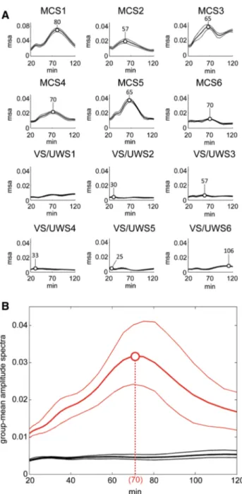 Figure 6 (first row), shows the group-averaged ampli- ampli-tude spectra: the MCS group is characterized by a  well-defined peak corresponding to the oscillatory component at 70 min holding for all three derivations, whereas no meaningful peak could be ide