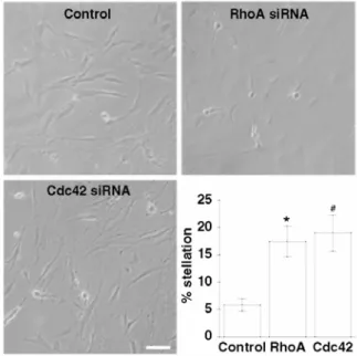 Fig. 2 Effects of RhoA or Cdc42 siRNA transfection on pituicyte morphology. Phase-contrast microphotographs  show pituicyte cultures under each relevant condition as indicated