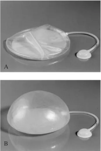 Fig 1 (A,B). Silicone tissue expander. (A): empty, (B): filled with isotonic saline solution