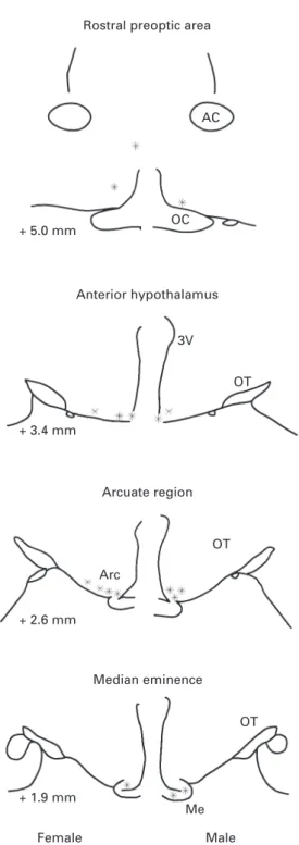 Fig. 2. Camera lucida drawings of coronal sections through the rostral preoptic area (+ 5.0 mm anterior to the interaural line), anterior hypothalamus (+ 3.4 mm), arcuate region (+ 2.6 mm), and median eminence (+ 1.9 mm) showing the distribution of GnRH mR