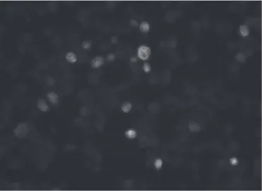 Figure  1:  Western  blotting  analysis  of  PiCV  ORF  C1  protein  expressed  in  insect  cells  Sf9