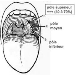 Figure 7 : Schéma anatomique de l'atteinte préférentielle de l'abcès péri-amygdalien 