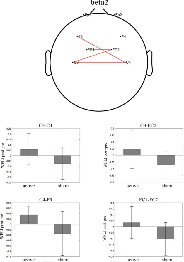 Fig. 2. Electrode pairs with higher difference in weighted phase lag index ( D WPLI) between the active versus sham stimulation for the beta2 band at the scalp level (upper panel, red lines)