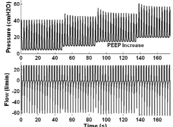 Fig.  2.  Example  of  PV  loops  with  volume  change  PEEP change. 