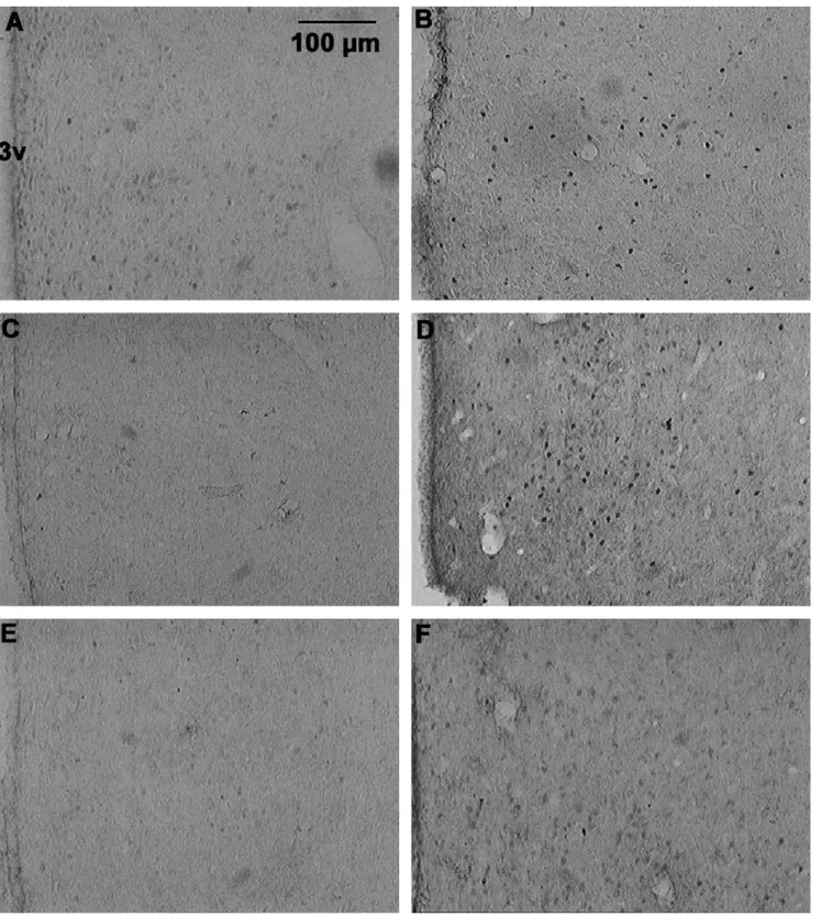 Fig. 3. Representative photomicrographs showing neuronal Fos-IR in the MPOA of female subjects prenatally treated with oil (A and B), ATD (C and D) or Flutamide (E and F)
