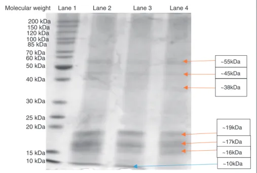 Figure 2. Electrophoretic profile of Spirulina protein fractions: 10–200 kDa molecular weight marker (Bio Basic Inc.) (Lane 1), TSSP fraction (Lane 2); BSSP fraction (Lane 3), and GSSP fraction (Lane 4).