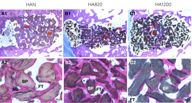 Figure 3. Descriptive histology after 3 months. BP, bone particle; NB, newly formed bone; FT, fibrous 