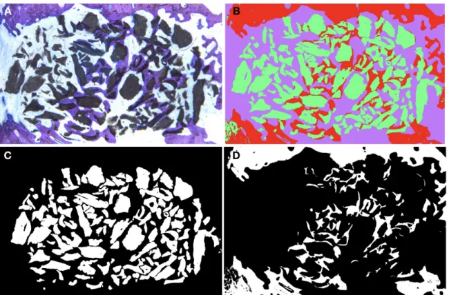 Figure 5. Histomorphometry segmentation steps; A Example of histological cut HA820; B Color  segmentation using ImageJ; C Binary image isolating all the particles of bovine hydroxyapatites  (BHA); D Binary image isolating the bone content