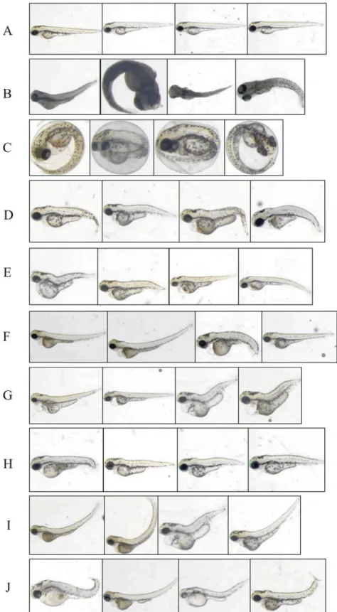 Figure 2. Examples of images representing all the analyzed phenotypes. “ Without phenotype ” defect, also called “ Normal ” embryos (A) are without any phenotype