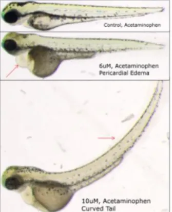 Figure 2. Number of images in each class (normal, edema or  curved tail) in the three experiments A, B and C.