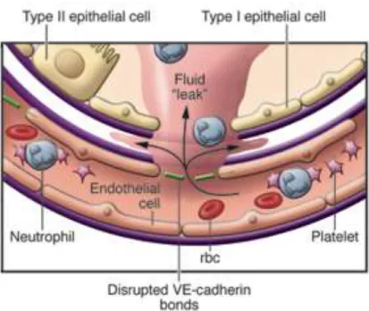 Fig. 3: Dysfonction des barrières micro-vasculaire et épithéliale 