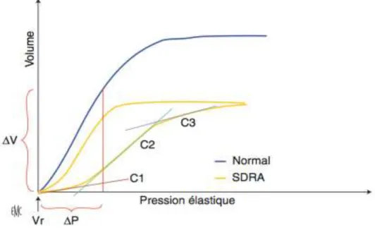 Fig 4: Courbe de pression – volume du système respiratoire en inspiration puis  expiration chez un patient normal et chez un patient en SDRA