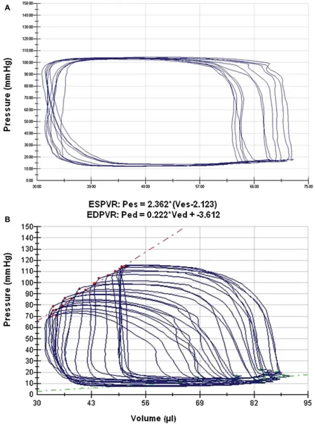Figure 5. Representative PV loops in G-CSF treated mice (A) during baseline state and (B) after pre-load reduction obtained by gently  compressing the inferior vena cava.