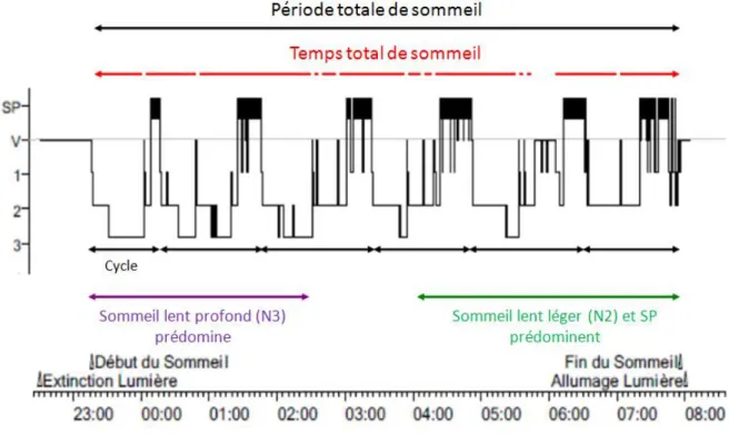 Figure 4 : Hypnogramme normal. SP : sommeil paradoxal, V : veille, 1-2-3 : stades de sommeil