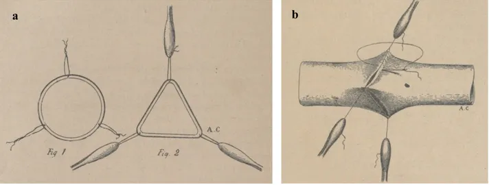 Figure 1 : a et b : technique de la triangulation selon Carrel(15) 