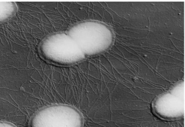 Figure 2 : Gonocoque en microscopie électronique, national institute of biomedical imaging 