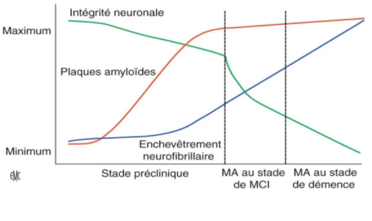 Figure 1.  Chronologie des lésions dans la maladie d'Alzheimer,  adapté de Perrin et al
