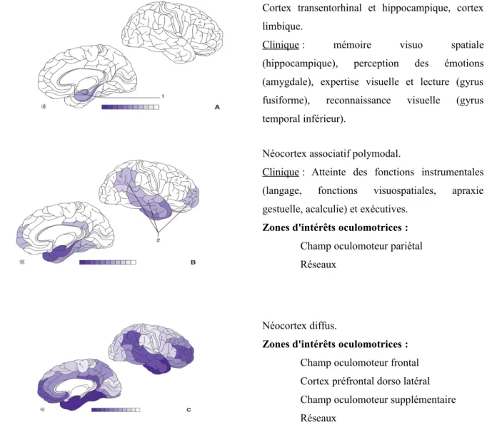 Figure   6.  Progression   des   lésions   de   dégénérescence   neurofibrillaire   et   possible   zones d’intérêts   oculomotrices   concernées   par   les   lésions