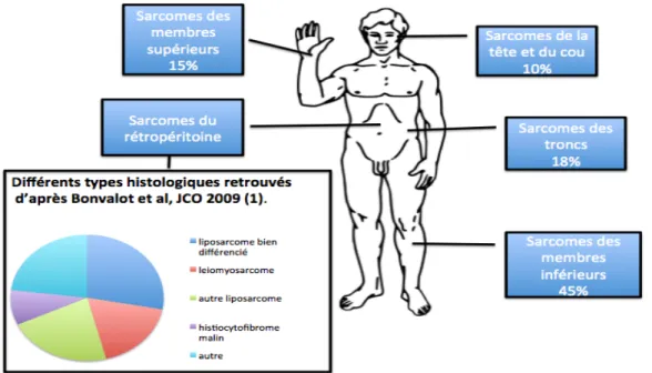Figure    1   :    Répartition    anatomique    des    Sarcomes    des    Tissus    Mous    et    répartition    histologique   des   Sarcomes   du   Rétropéritoine   d’après   Bonvalot   et   al,   JCO   2009(1)