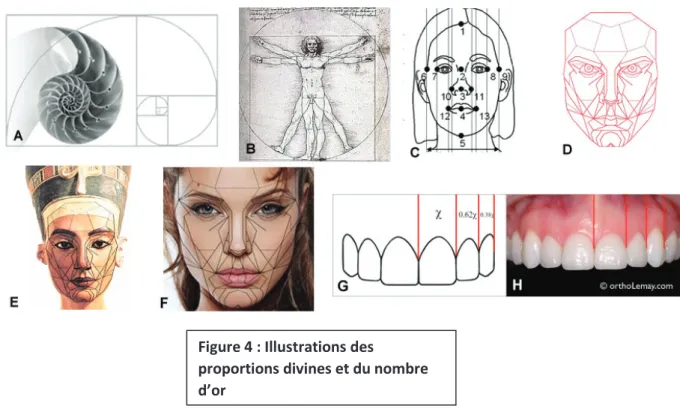 Figure 4 : Illustrations des 