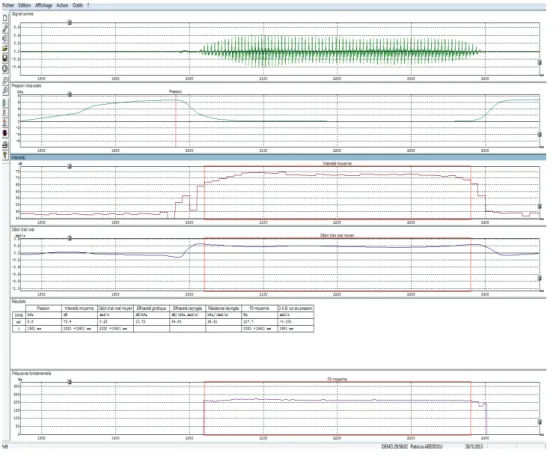 Figure 10 : Mesure de la pression sur la syllabe /pa/ dans SESANE 