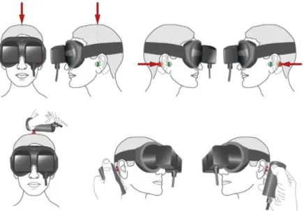 Figure 2.  The vibration-induced nystagmus complements other vestibular tests in the vestibule  multifrequency  analysis
