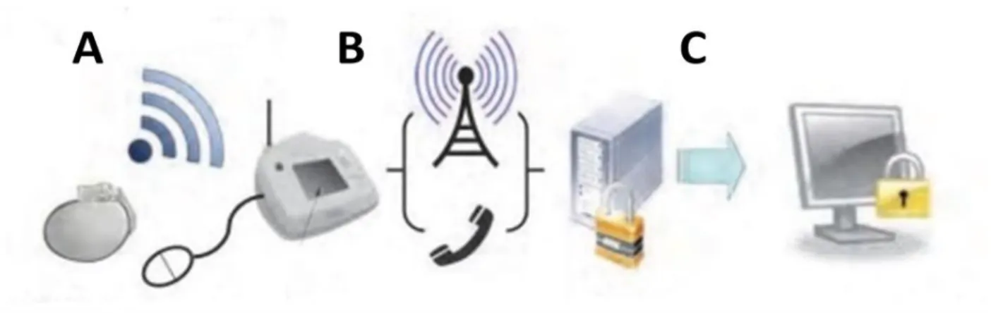 Figure 1 : Schéma du fonctionnement de la télécardiologie :  A : Transmission des données du DAI vers le boitier de télécardiologie  B