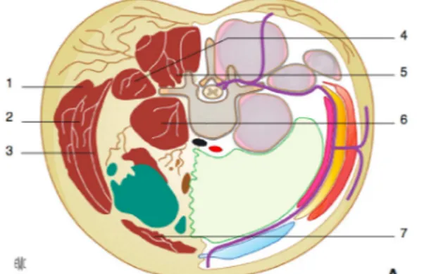 Figure 2 : Coupe axiale passant par T12 et montrant le nerf T12 cheminant dans la paroi et son passage dans le  plan transverse entre les muscles oblique interne (2) et transverse (3)