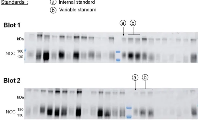 Figure 1: Description of the internal standards used to take into account the variability of the western  blot procedure from one membrane to another, and the wide range of urine dilution between samples  of KT and volunteers
