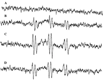 Fig. 5. Effects of EGb 761 on EPR spectra obtained with POBN/