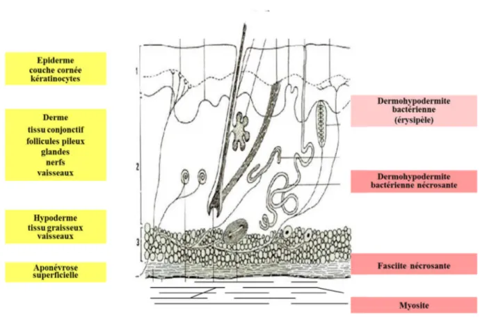 Figure II.1 : Anatomie de la peau et infections cutanées, selon « Skin and soft tissue infection : classifying and treatin a spectrum »,[30]