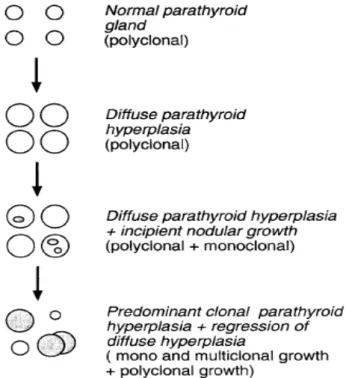 Figure  4  :  Évolution  morphologique  du  tissu  parathyroïdien  au  cours  de  l'insuffisance  rénale chronique 