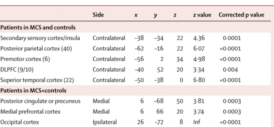 Table 4: Areas that show preserved functional connectivity in patients in MCS and controls and in  patients  in MCS compared with patients in PVS