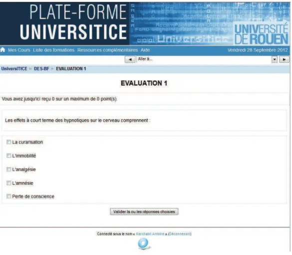 Figure 6 : 1 er  QCM du module « Action des agents anesthésiques sur le système nerveux  central » 