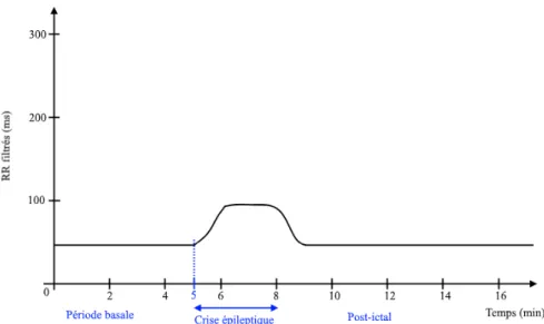 Figure  8 : Schéma illustrant l’évolution dynamique de l’intervalle RR en période ictale, tel  que visualisée sur le logiciel d’analyse des paramètres de VFC