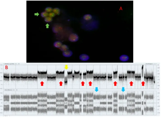 Figure 18. Résultats des analyses de cytogénétique du cas n°3 