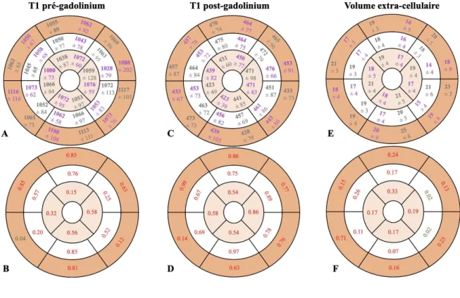 Figure 4. T2 mapping en ms selon les 17 segments (représentation bull-eye) 