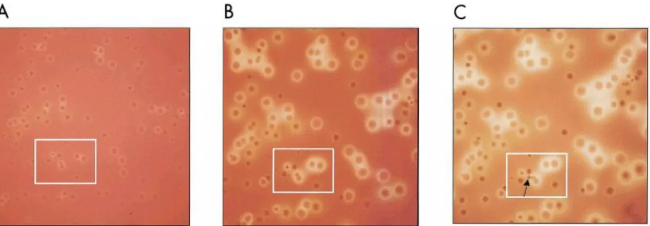 Figure 13. Variations de la morphologie des colonies d'entérocoque  sur gélose Columbia  avec 5 % de sang de cheval après 24h (A), 48h (B) et 72h (C) d'incubation à 37 ° C  (64)         