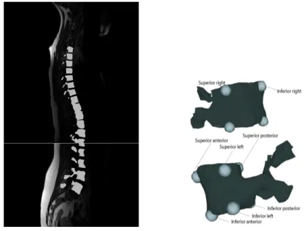 Figure 4.1 3D reconstruction of vertebrae from MRI sagittal slices along with manually labeled landmarks on each of the vertebrae.