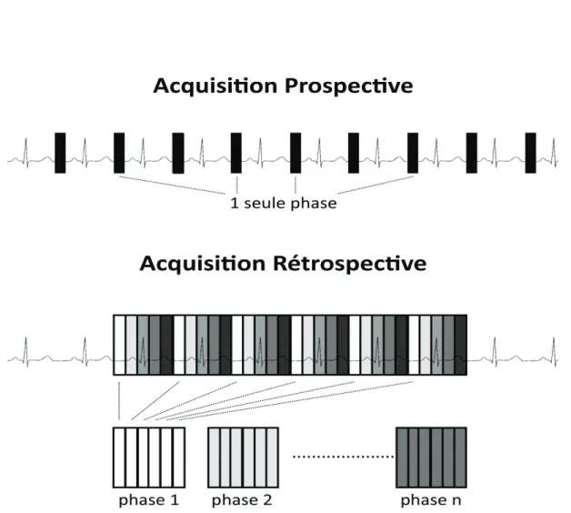 Figure 7: Schémas dacquisition par les méthodes prospective et rétrospective 