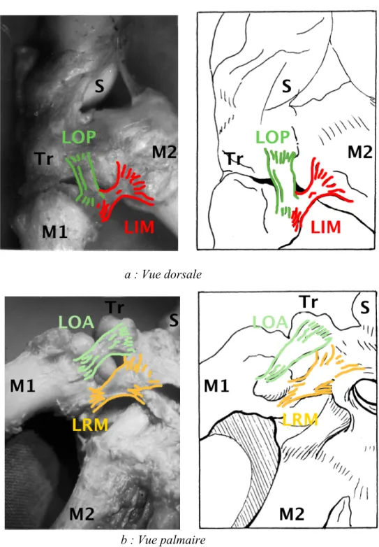 Figure 3b : Les quatre ligaments du complexe ligamentaire postéromédial trapézométacarpien  d’après Kuhlmann [6], composé des ligaments oblique postérieur (LOP), intermétacarpien 