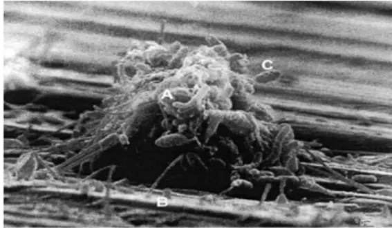 Figure 1 : Biofilm en microscopie électronique.  